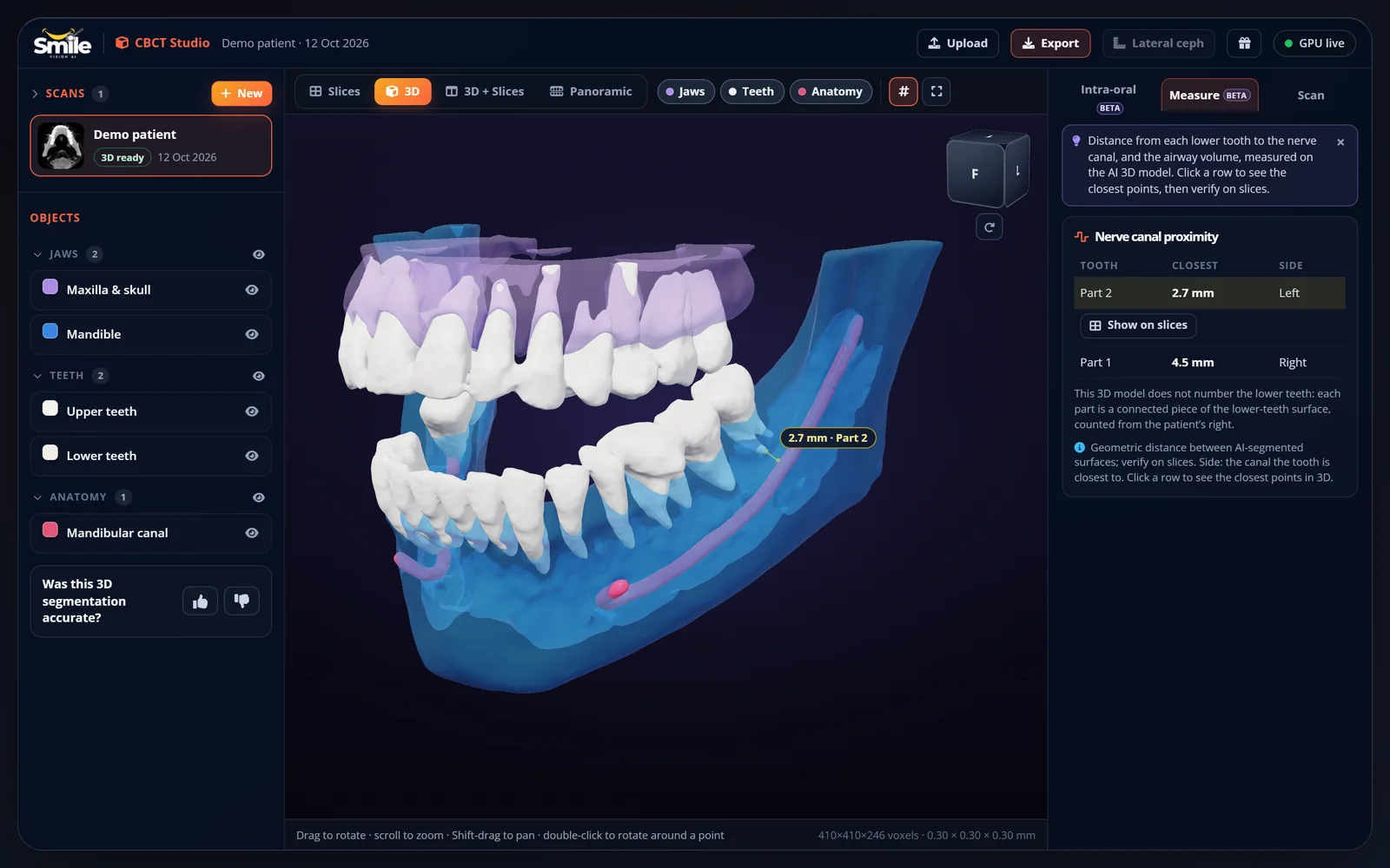 CBCT Studio measuring distance from teeth to the nerve canal