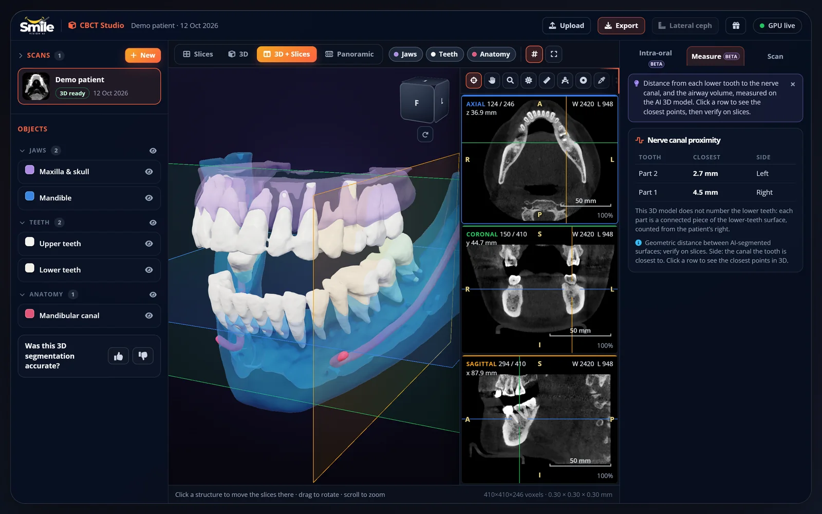 CBCT Studio with 3D segmentation and MPR slices