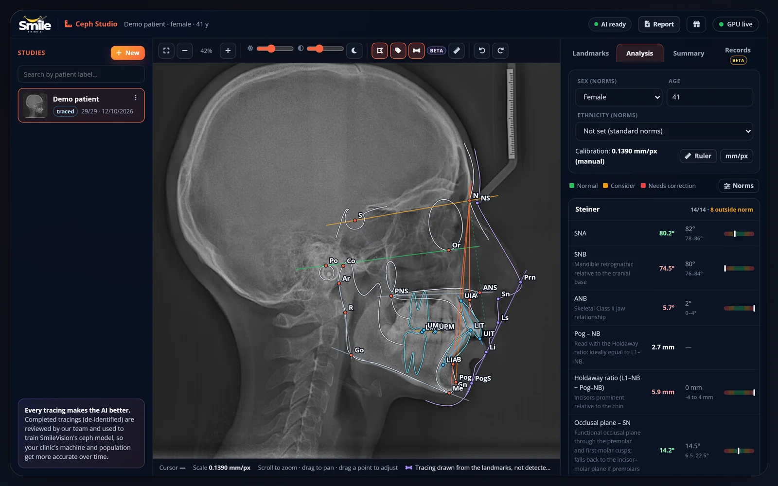 Ceph Studio with AI landmarks, tracing and Steiner values