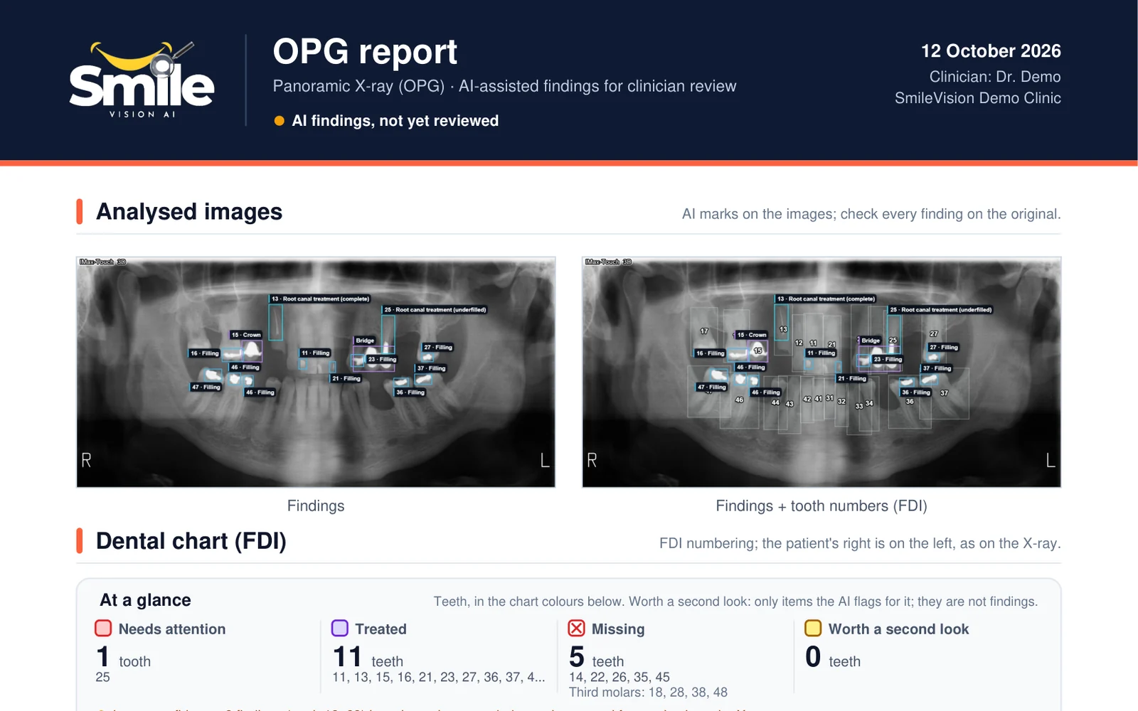 OPG PDF report with the annotated film and dental chart