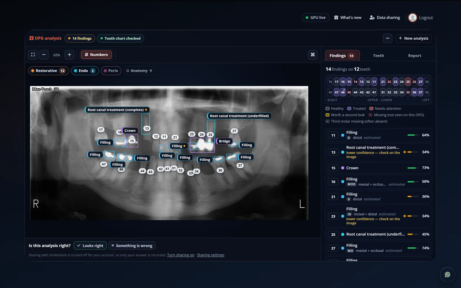OPG analysis screen with 14 findings on the film